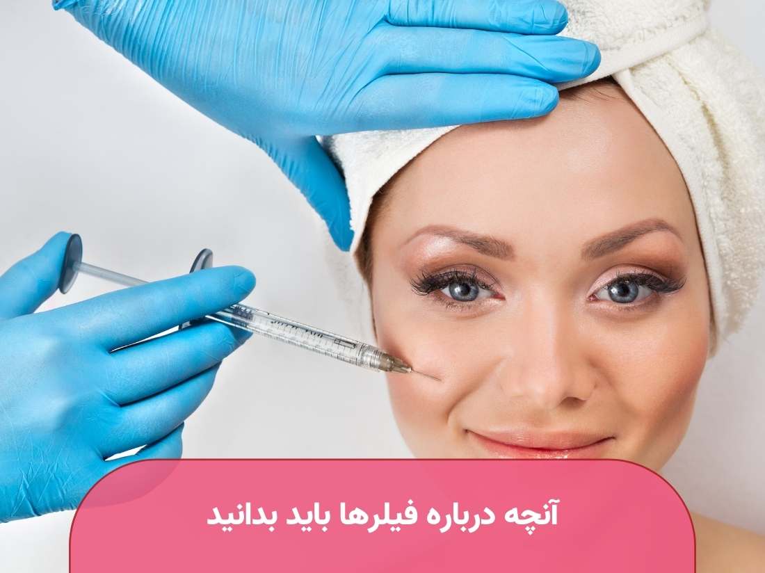 آنچه-درباره-فیلرها-باید-بدانید